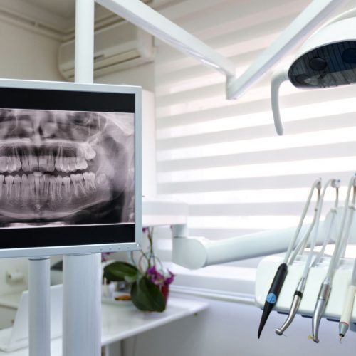 banner-Dental-Implants-Cost