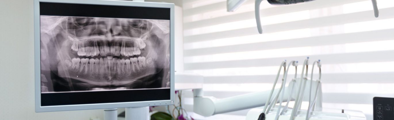 banner-Dental-Implants-Cost