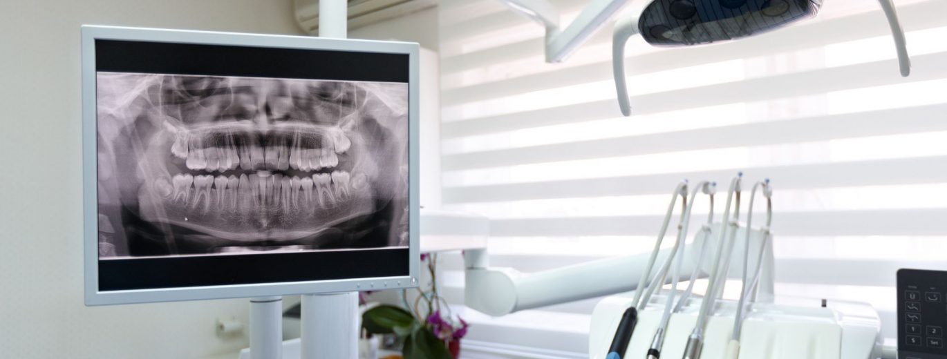 banner-Dental-Implants-Cost