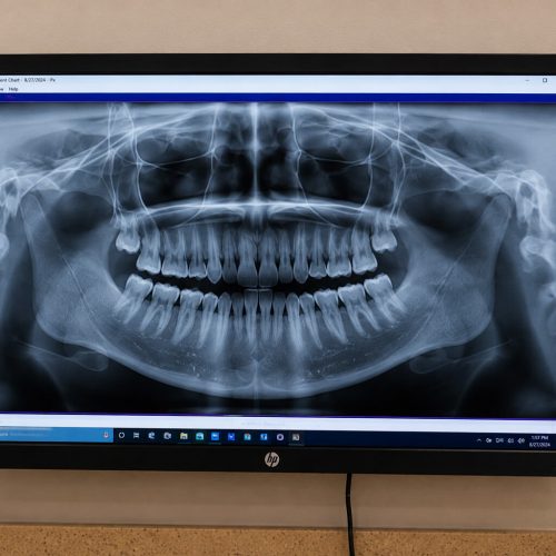 banner-radiography