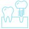 icon-dental-implants-new