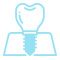 icon-implant-procedure-new